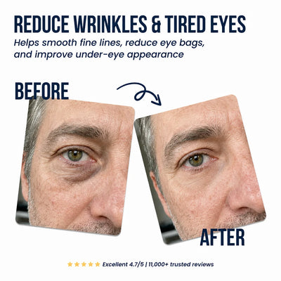 AUREN Under-Eye Repair Patches before and after gallery image